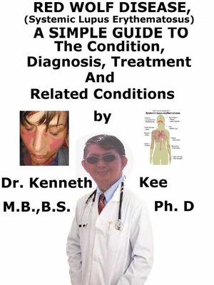 cover image of Red Wolf Disease (Systemic Lupus Erythematosus), a Simple Guide to the Condition, Diagnosis, Treatment and Related Conditions
